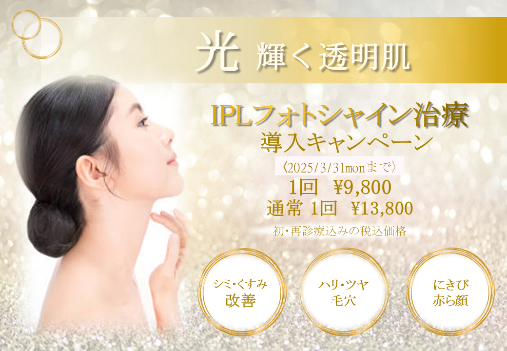 IPLフォトシャイン治療 導入キャンペーン